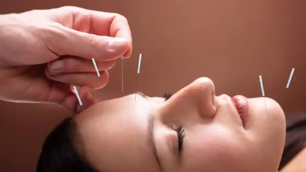 Como divulgar serviços de acupuntura: Estratégias eficazes Como divulgar serviços de acupuntura